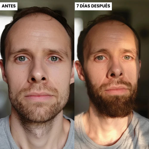 Aceite Volumizador para Barba