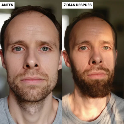 Aceite Volumizador para Barba